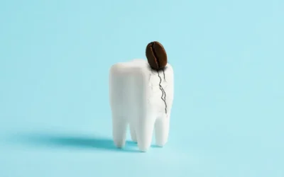 Wat is er aan de hand bij een barst of scheur in uw tand?